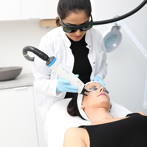 Fractional laser